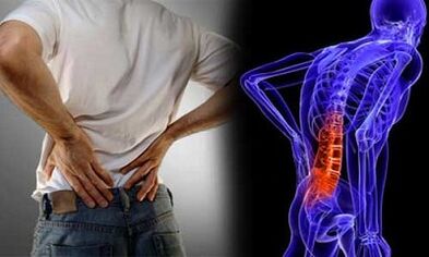Az ágyéki osteochondrosis kialakulásának okai